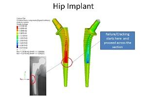 MeshWorks by DEP Extend the Life of Hip Implants